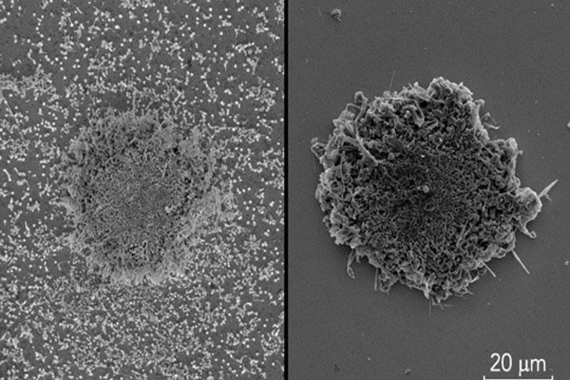 Microscopic images of lithium metal buildup in batteries